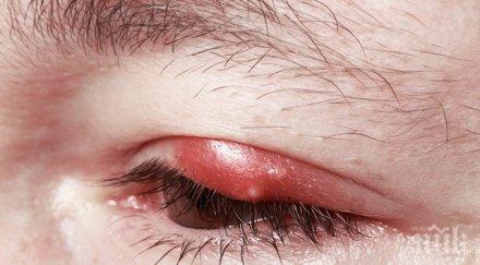 внимавайте мръсните хавлии докарват ечемик