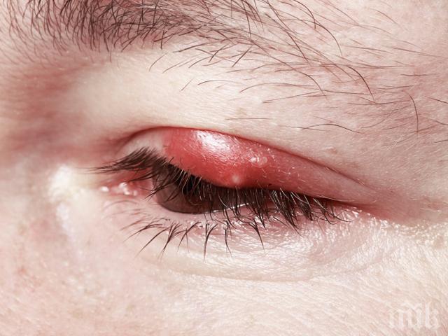 Внимавайте! Мръсните хавлии докарват ечемик