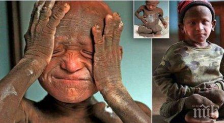 ужас рядко заболяване превръща кожата камък видео снимки