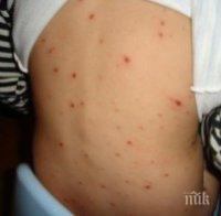 В пловдивския кв. „Столипиново“ пребориха шарката