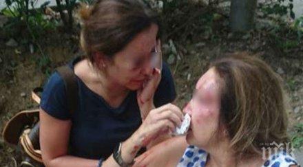 изписаха битата нотариуска болницата