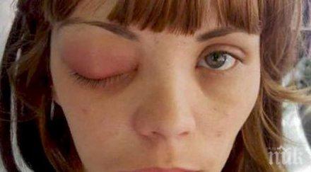 ужас млада жена остана без око посещение стоматолог