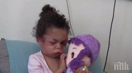 ужасът войната годишно момиченце оцеля чудо атентат йемен видео