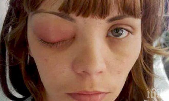 УЖАС! Млада жена едва не остана без око след посещение при... стоматолог 