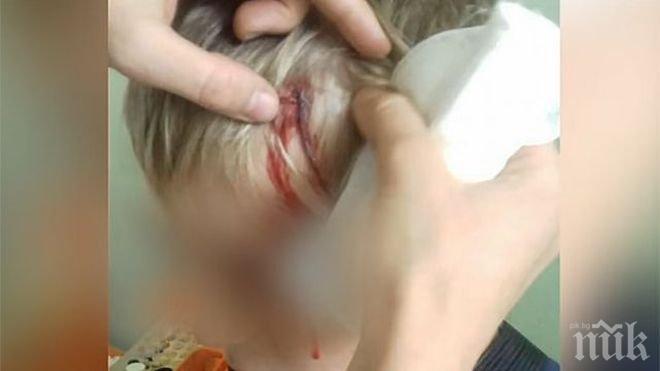 НЕРВАК! Пенсионер стреля играещи деца, пречели му на спокойствието 