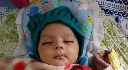 феномен бебе роди зъби лекарите извадиха снимка