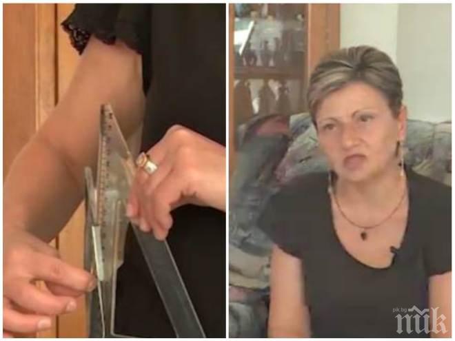 ШОКИРАЩ СЛУЧАЙ! Българка живее 3 години със забравена в корема пинсета