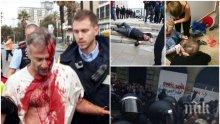 УЖАСЪТ В КАТАЛУНИЯ! Пребита на референдума: Счупиха ми пръстите един по един и ме опипваха (ШОКИРАЩИ СНИМКИ/ВИДЕО 18+)