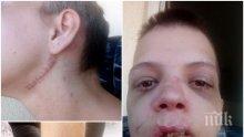 УЖАСЯВАЩО! Българска секс робиня с шокиращи разкази за зверствата върху нея (СНИМКИ 18+)