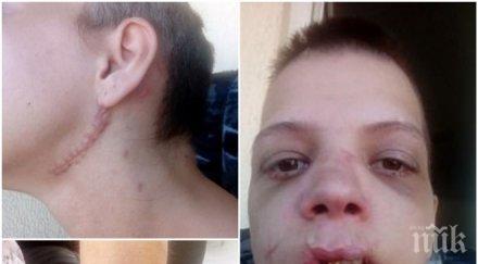 ужасяващо българска секс робиня шокиращи разкази зверствата нея снимки