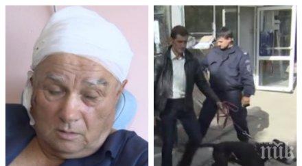 нападнатият питбул старец отхапа една трета ухото
