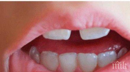 внимание афтите издават опасни болести вижте тревожите