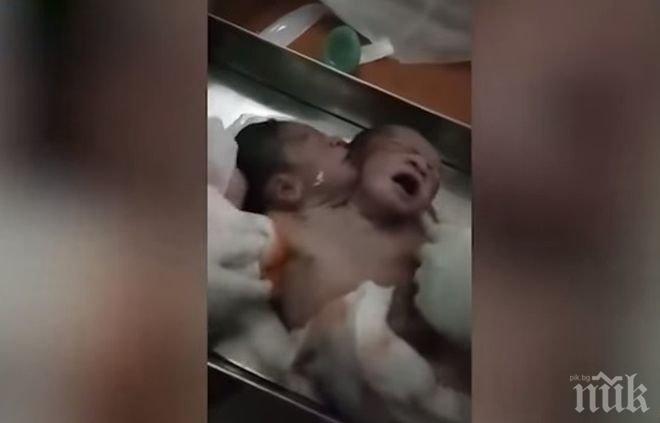 Аномалия! В Индия се роди бебе с две глави (ВИДЕО)
