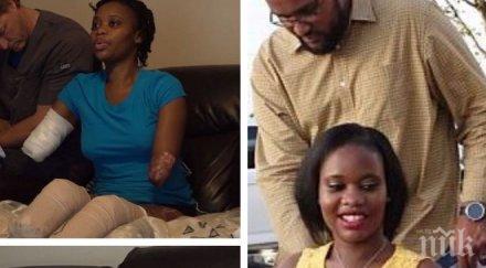 ужасяващо американка загуби време бременността ръцете краката бебето