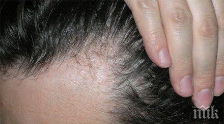 гъбичките появяват първо косата