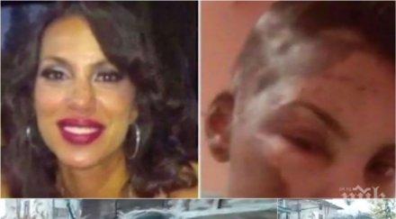 разтърсващи разкрития бащата залятата киселина бела видял ужаса очите разказа сълзи цялата глава пушеше