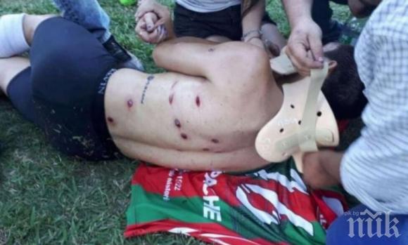 Невиждан терор! Полицаи надупчиха футболист с 13 куршума по време на мач (ВИДЕО/СНИМКИ)