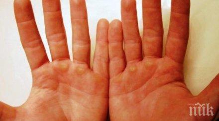 внимание ракът избива дланите