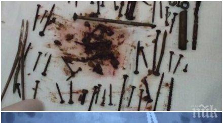 руски лекари извадиха 150 метални предмета стомаха баба