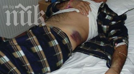 пребиха зверски тояги член секционна комисия