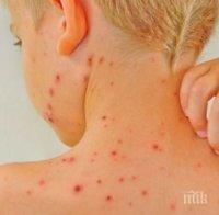 Варицела плъзна из детските градини в Перник