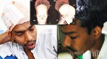 рекорд хирурзи извадиха мозъка индиец големия тумор света снимки