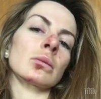 Сани Жекова падна тежко - извади рамо и охлузи лицето си (СНИМКА)