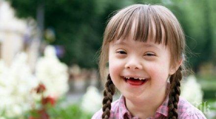 международен ден хората синдрома даун