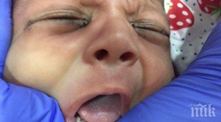 новороденото бебе извадиха зъба вече храни нормално