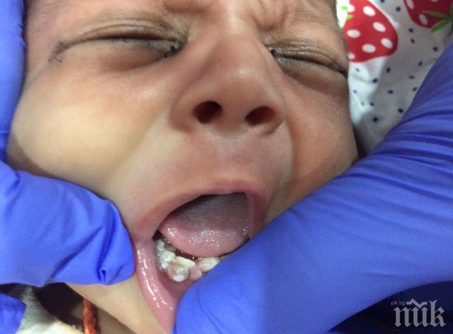 Новороденото бебе, на което извадиха 7 зъба, вече се храни нормално
