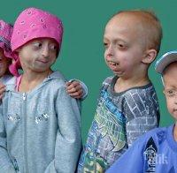 НАДЕЖДА! Откриха лечение за деца, засегнати от прогерия