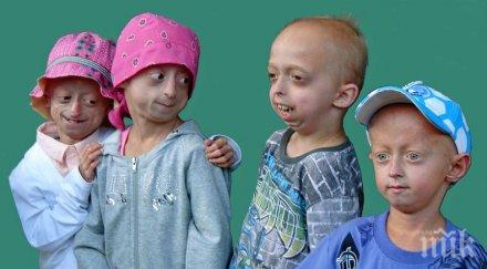 надежда откриха лечение деца засегнати прогерия