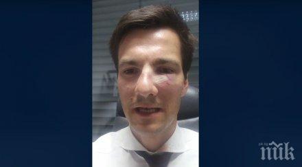 брутална атака избиха зъб счупиха носа новоизбран кмет докато куфее победата