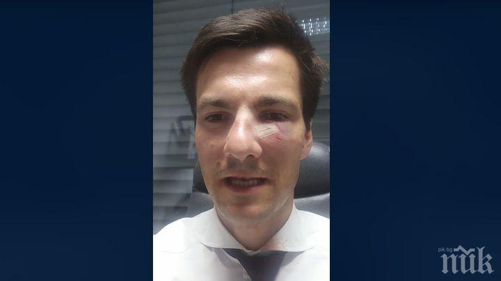 БРУТАЛНА АТАКА! Избиха зъб и счупиха носа на новоизбран кмет, докато куфее след победата