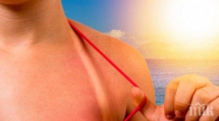 домашна аптека първа помощ слънчево изгаряне