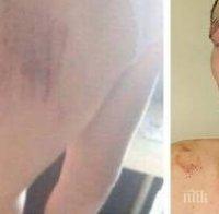 КЪРВАВ БАЛ! Батки пребиха абитуриент след запой в дискотека 