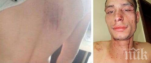 КЪРВАВ БАЛ! Батки пребиха абитуриент след запой в дискотека 