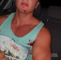 КЪРВАВО НАПАДЕНИЕ! Раниха тежко с нож бургазлията Иван 