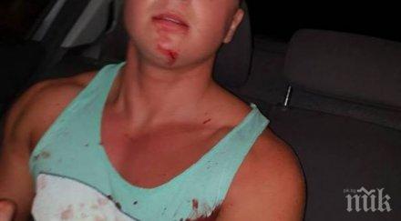 кърваво нападение раниха тежко нож бургазлията иван