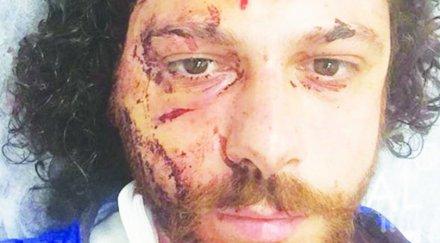 пребиха звезда черна любов