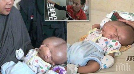 аномалия индонезия роди бебе две лица видео