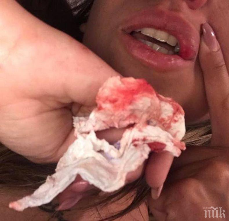 ИСТОРИЯТА СЕ ОБРЪЩА! Нападната ли е красивата Инес от бургаска батка в Слънчев бряг?