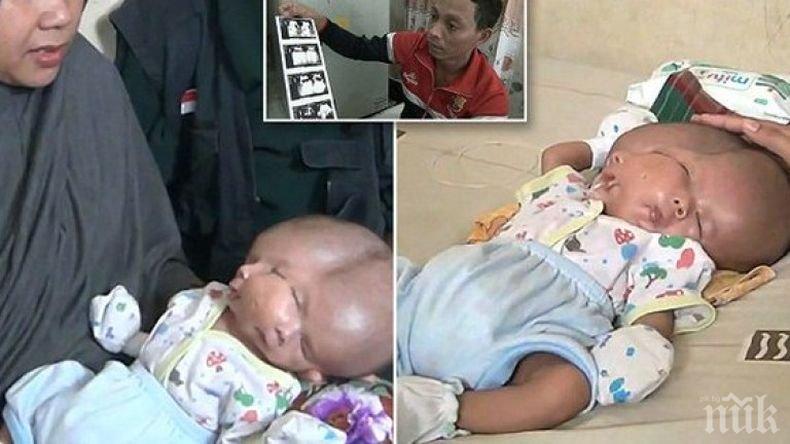 АНОМАЛИЯ! В Индонезия се роди бебе с две лица (ВИДЕО 18+)