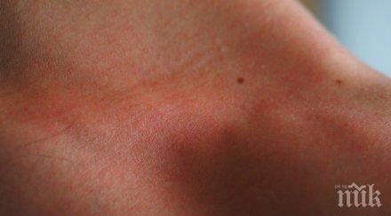 внимавайте промяна цвета бенката издава меланом