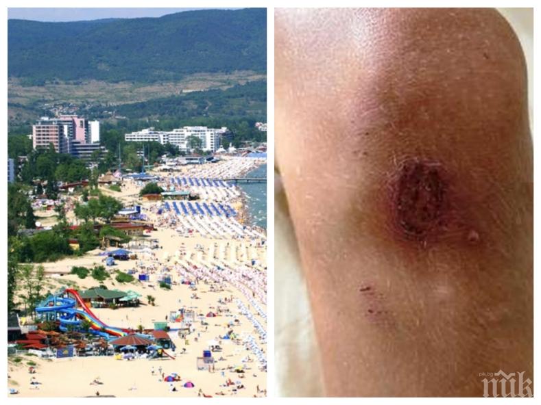 МЕЖДУНАРОДЕН СКАНДАЛ! 10-годишният син на руски бизнесмен бит от гард в Слънчев бряг - уведомени са консулството и МВнР