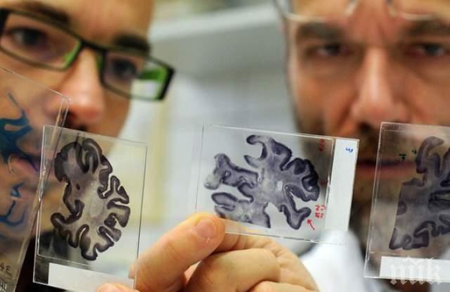 ЛИЧНА ДРАМА! Жена отключи Алцхаймер, след като я съкратиха от работа