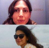 Асоциацията на университетските болници дари 3 000 лв. за лечението на падналата от 7-ия етаж лекарка