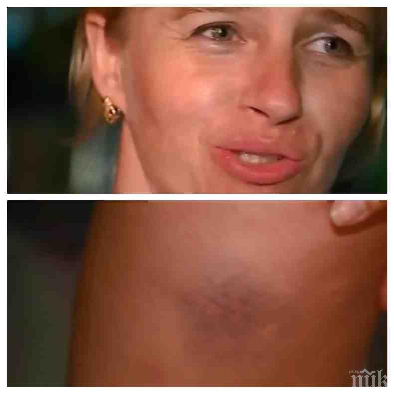 Прокуратурата за битата камериерка: Тя призна, че е хапала управителя на хотела