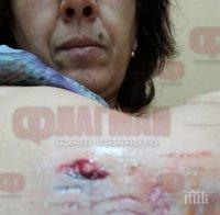 Агресивен ротвайлер нахапа жестоко бургазлийка