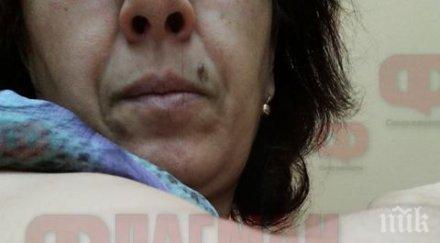 агресивен ротвайлер нахапа жестоко бургазлийка